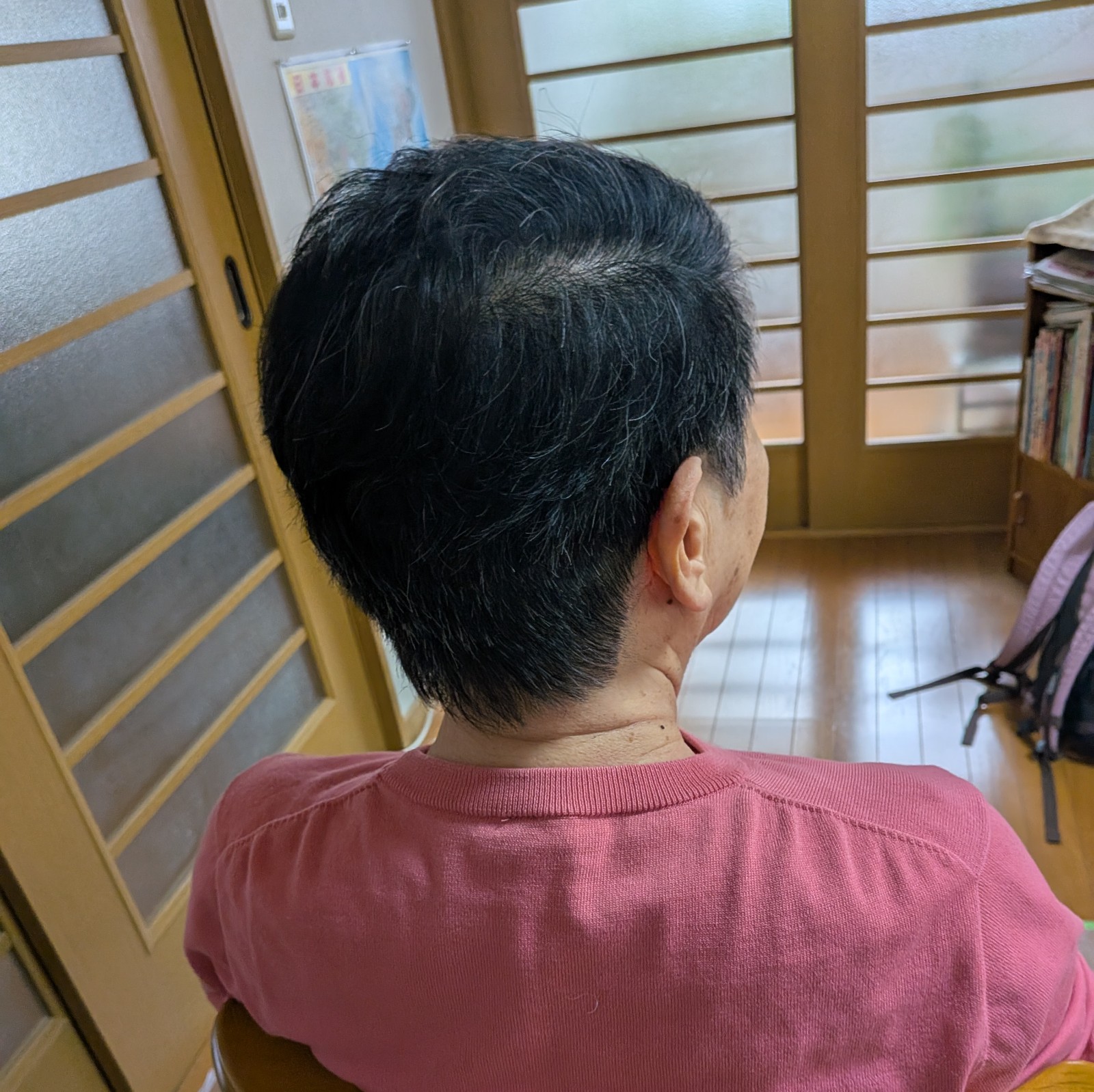 施術写真 5