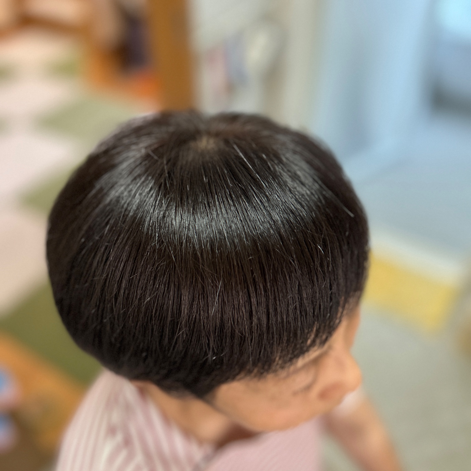 施術写真 2