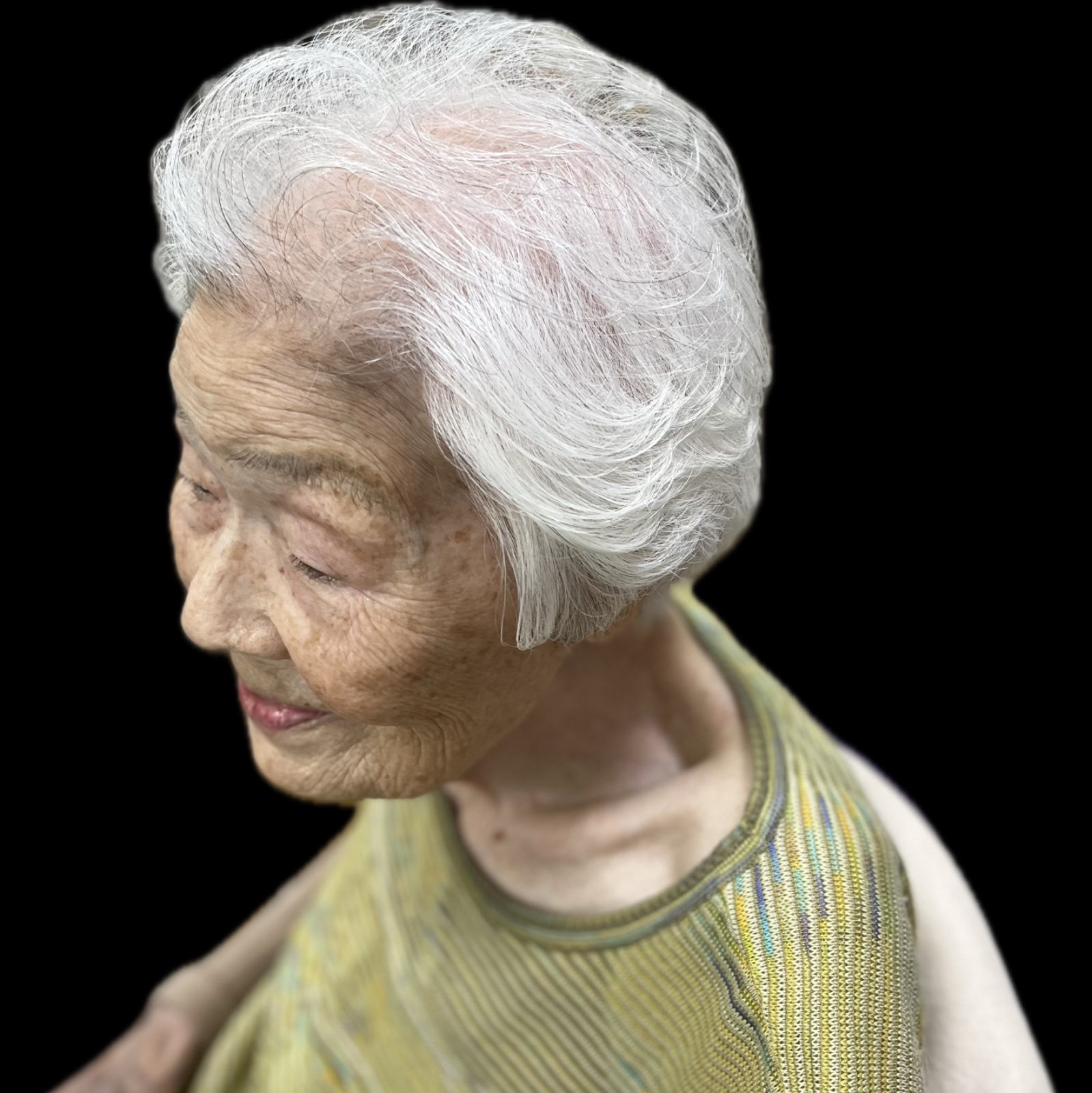 施術写真 3