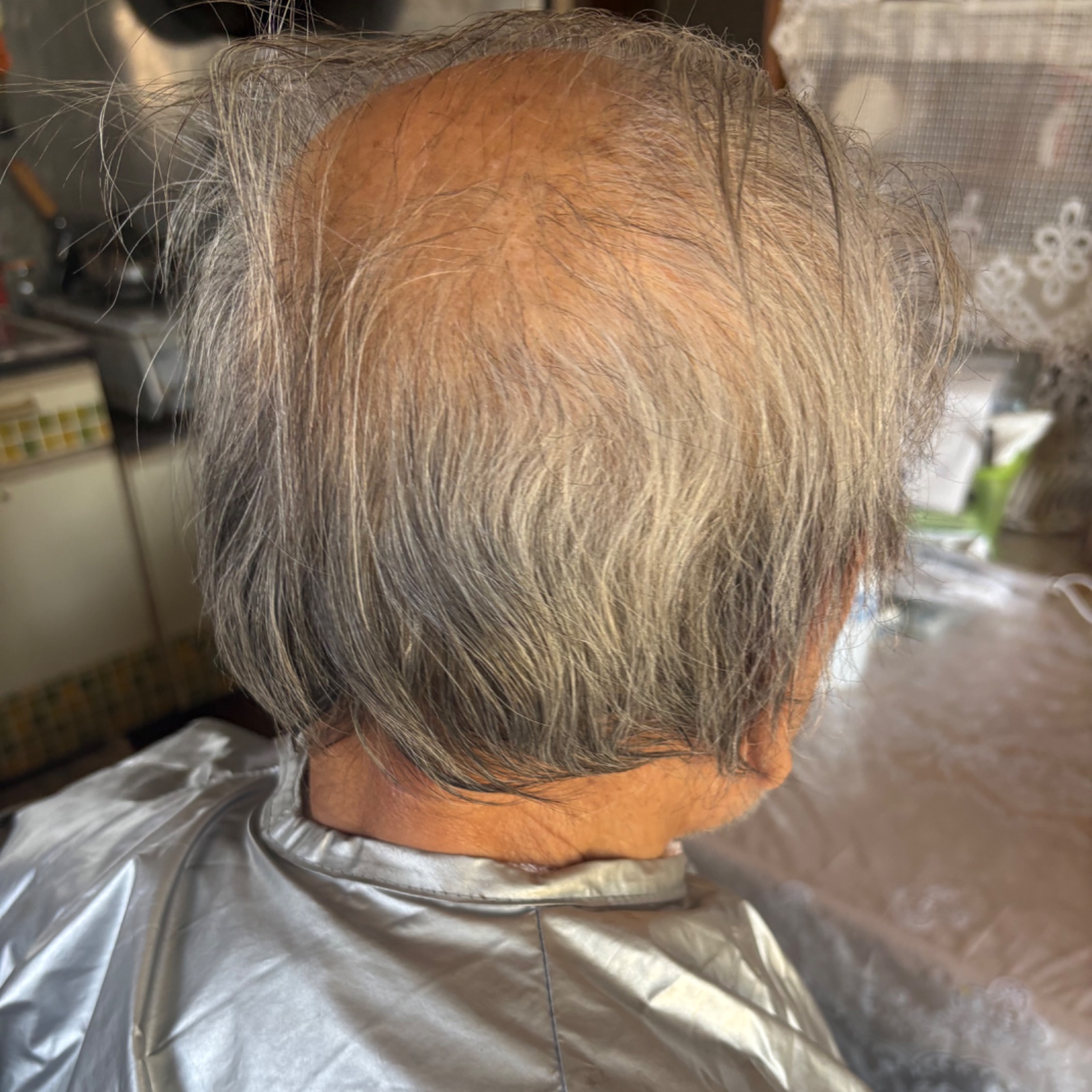 施術写真 5