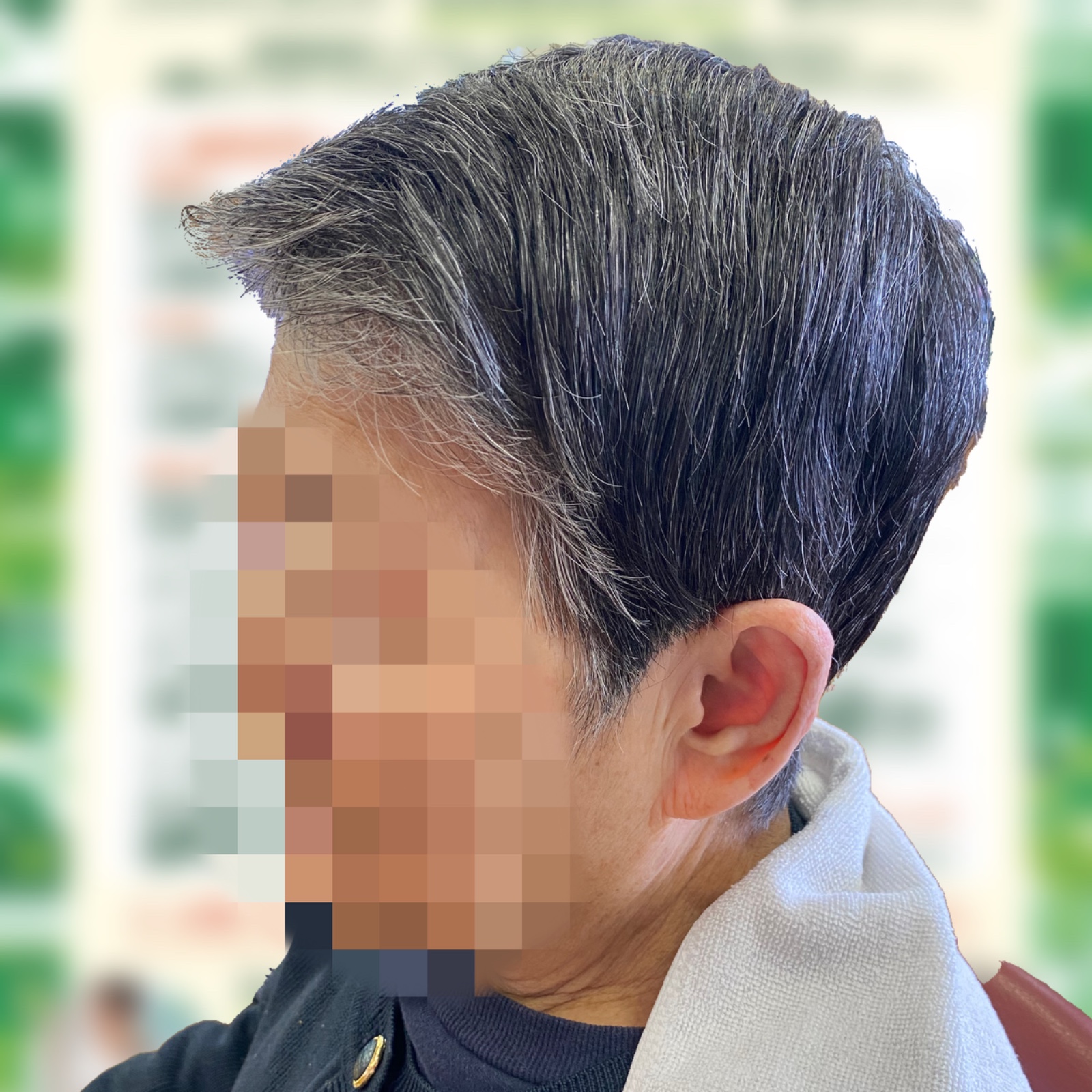 施術写真 5